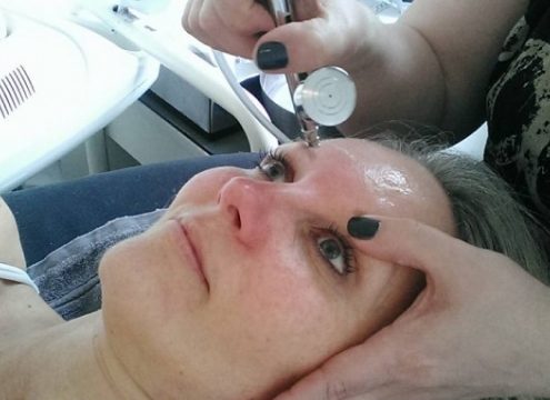 Oxygen lift “Madonna behandling” – sådan virker den!