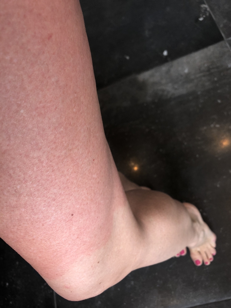 cellulite creme phformula